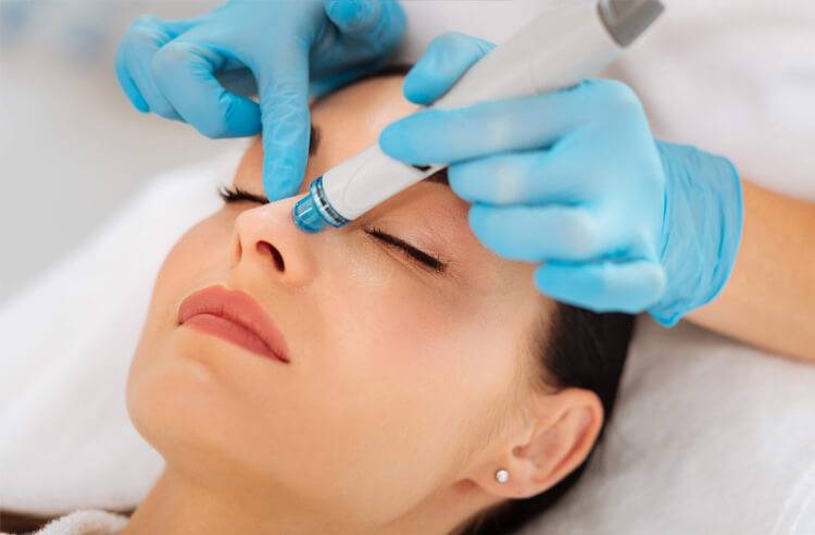 美容 Aqualpeel